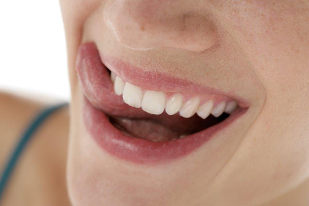 Das Bild zeigt die weißen Zähne einer Frau